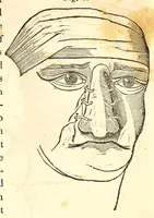 An illustration from The American journal of the medical sciences (1827)
