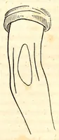 An illustration from The American journal of the medical sciences (1827)