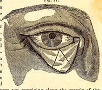 An illustration from The American journal of the medical sciences (1827)
