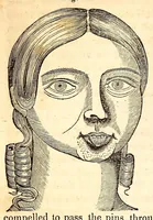 An illustration from The American journal of the medical sciences (1827)