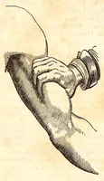 An illustration from The American journal of the medical sciences (1827)