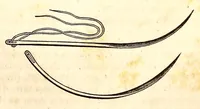 An illustration from The American journal of the medical sciences (1827)