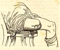 Picture 12 of 13 from The American journal of the medical sciences (1827), leaf 417