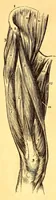 An illustration from The American journal of the medical sciences (1827)