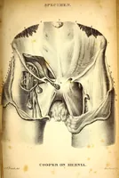 Picture 10 of 13 from The American journal of the medical sciences (1827), leaf 265