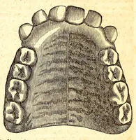 An illustration from The American journal of the medical sciences (1827)