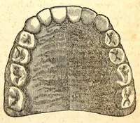 An illustration from The American journal of the medical sciences (1827)
