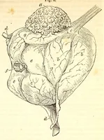 An illustration from The American journal of the medical sciences (1827)