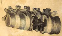 An illustration from The American journal of the medical sciences (1827)