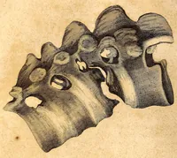 An illustration from The American journal of the medical sciences (1827)