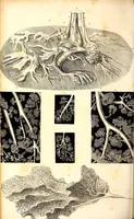 An illustration from The American journal of the medical sciences (1827)
