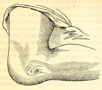 An illustration from The American journal of the medical sciences (1827)