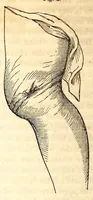 An illustration from The American journal of the medical sciences (1827)