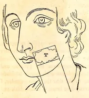 Picture 10 of 13 from The American journal of the medical sciences (1827), leaf 342