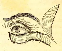 Picture 13 of 13 from The American journal of the medical sciences (1827), leaf 369