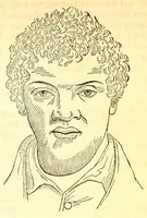 An illustration from The American journal of the medical sciences (1827)