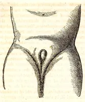Picture 6 of 7 from The American journal of the medical sciences (1827), leaf 392