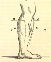 An illustration from The American journal of the medical sciences (1827)