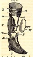 An illustration from The American journal of the medical sciences (1827)