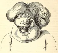 An illustration from The American journal of the medical sciences (1827)