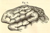 An illustration from The American journal of the medical sciences (1827)