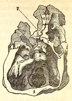 An illustration from The American journal of the medical sciences (1827)
