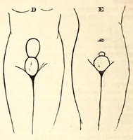 An illustration from The American journal of the medical sciences (1827)