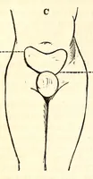 An illustration from The American journal of the medical sciences (1827)