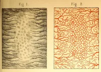 An illustration from The American journal of the medical sciences (1827)