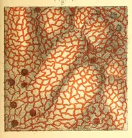 An illustration from The American journal of the medical sciences (1827)