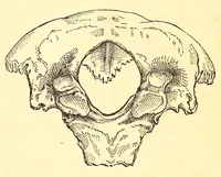 An illustration from The American journal of the medical sciences (1827)