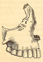An illustration from The American journal of the medical sciences (1827)