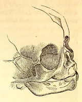 An illustration from The American journal of the medical sciences (1827)