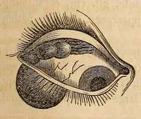 An illustration from The American journal of the medical sciences (1827)