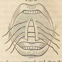 An illustration from The American journal of the medical sciences (1827)