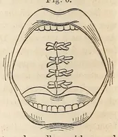 An illustration from The American journal of the medical sciences (1827)