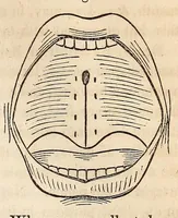 An illustration from The American journal of the medical sciences (1827)