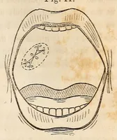 An illustration from The American journal of the medical sciences (1827)