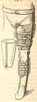An illustration from The American journal of the medical sciences (1827)