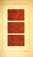 Picture 3 of 14 from The American journal of the medical sciences (1827), leaf 29