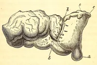 An illustration from The American journal of the medical sciences (1827)