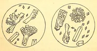 Picture 9 of 14 from The American journal of the medical sciences (1827), leaf 383