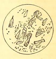 Picture 10 of 14 from The American journal of the medical sciences (1827), leaf 383