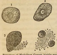 Picture 5 of 5 from The American journal of the medical sciences (1827), leaf 406