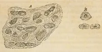 An illustration from The American journal of the medical sciences (1827)