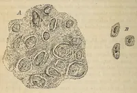 Picture 15 of 18 from The American journal of the medical sciences (1827), leaf 426