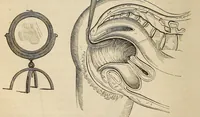 Picture 3 of 18 from The American journal of the medical sciences (1827), leaf 86