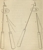An illustration from The American journal of the medical sciences (1827)