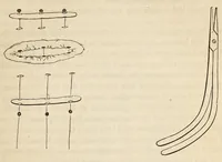 An illustration from The American journal of the medical sciences (1827)