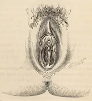 An illustration from The American journal of the medical sciences (1827)